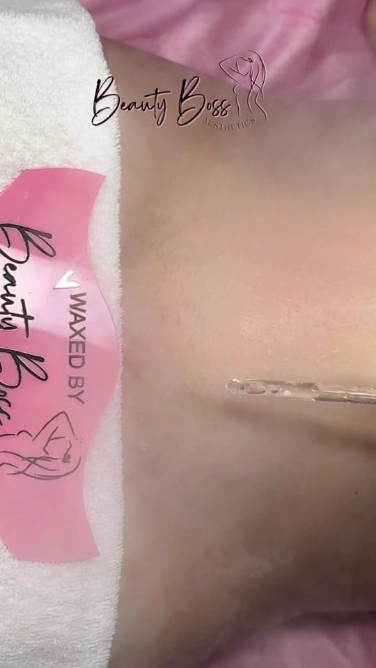 Post 8 by BeautyBossAesthetics on TikTok (video)