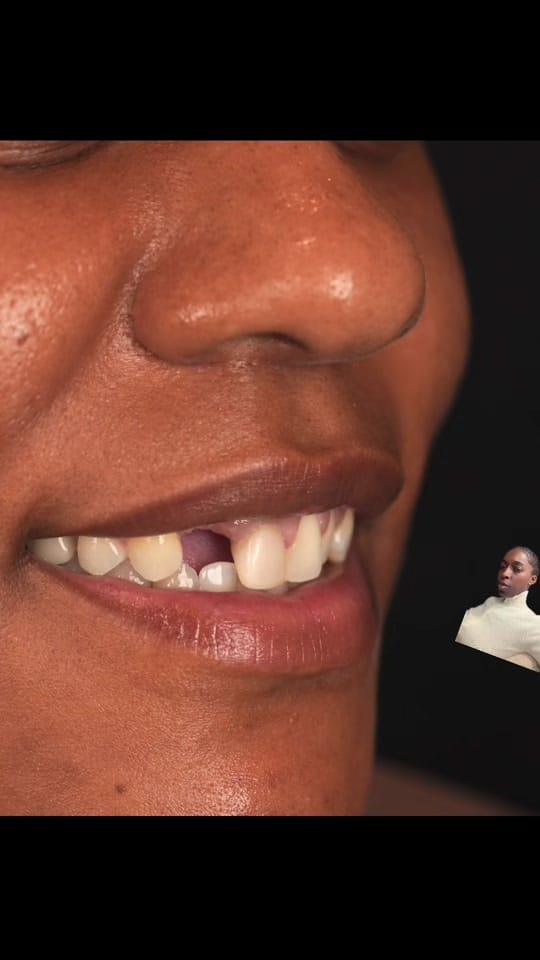 Post 6 by dr.teeloww on TikTok (video)