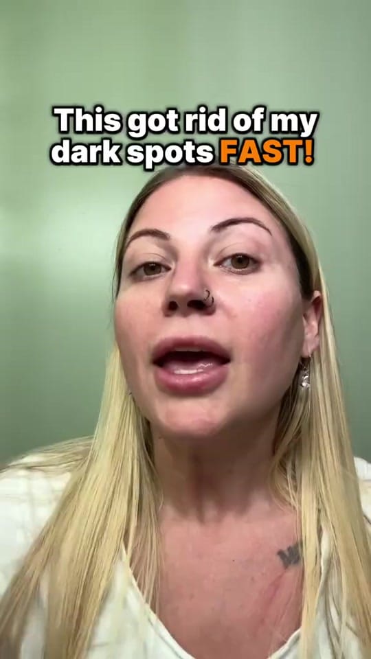 Post 3 by Skindeva on TikTok (video)