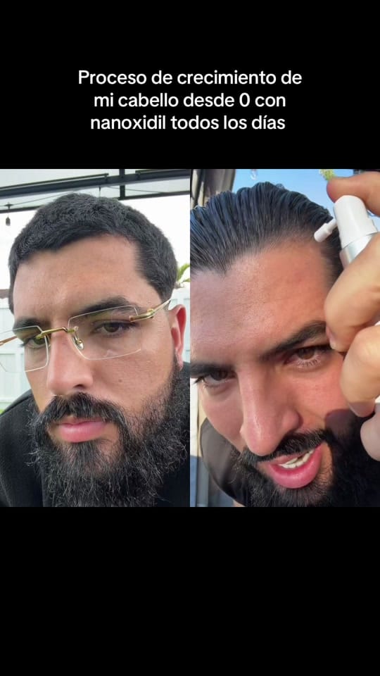 Post 2 by Gonzalo Costa on TikTok (video)
