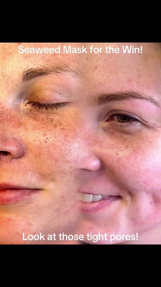 Post 5 by skincerely_yoursllc on TikTok (video)