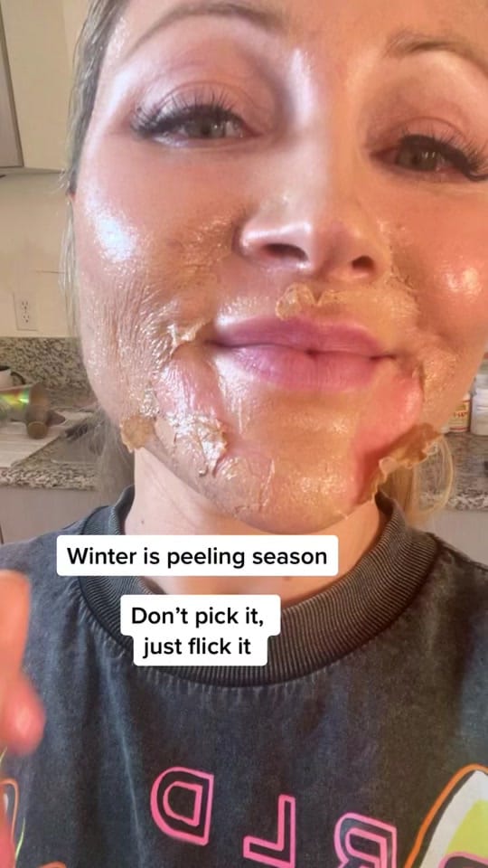 Post 10 by The Acne Guru on TikTok (video)