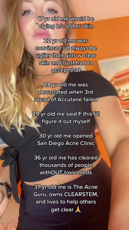 Post 8 by The Acne Guru on TikTok (video)