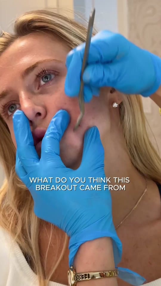 Post 3 by The Acne Guru on TikTok (video)