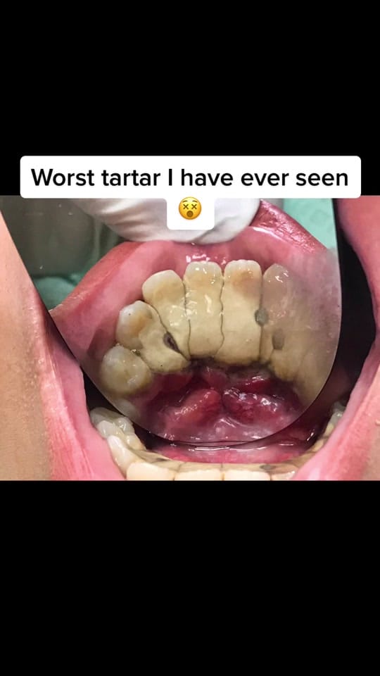 Post 9 by Terri Alani on TikTok (video)