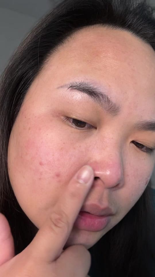 Post 2 by apollskincare 🇵🇭🇹🇼🇺🇸 on TikTok (video)