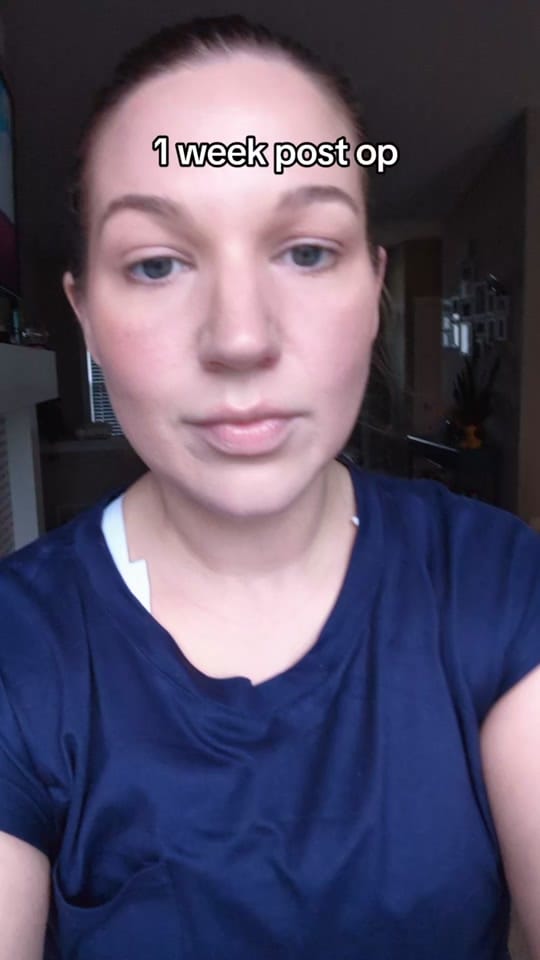 Post 1 by Kels✨PCOS & Wellness on TikTok (video)