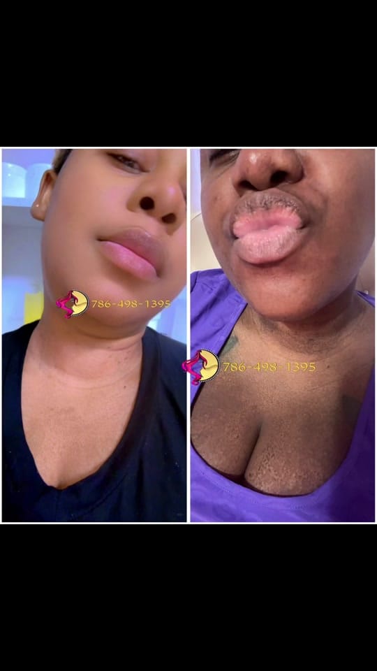 Post 10 by Liline Beauty Plus Florestal on TikTok (video)