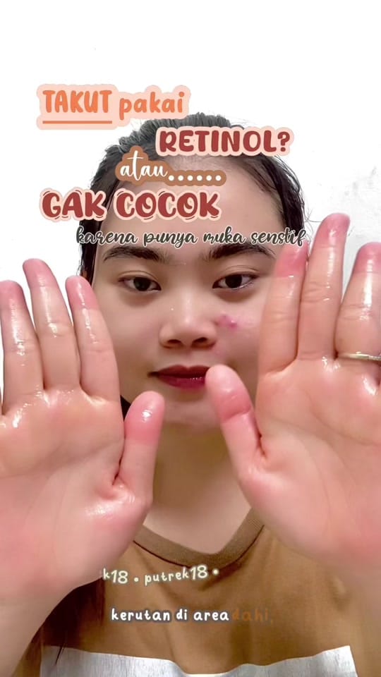 Post 2 by Putrek on TikTok (video)