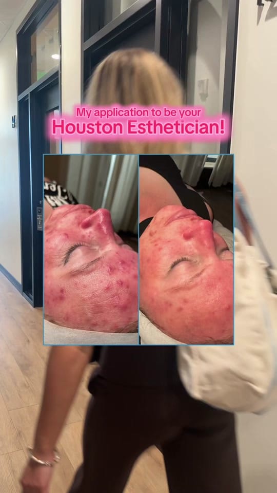 Post 6 by Christy | Aesthetician 💫 on TikTok (video)