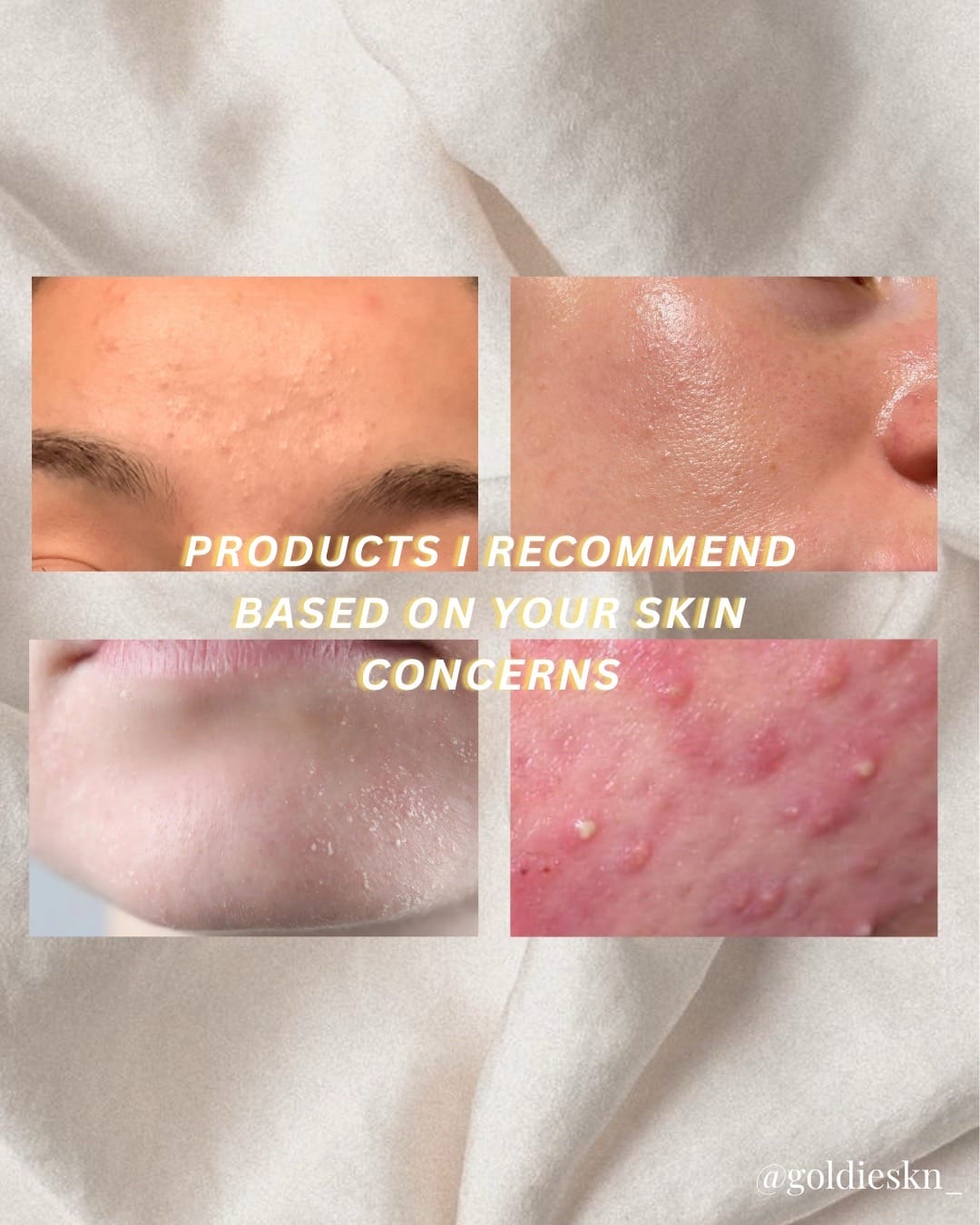 Post 10 by zadi 💫 | utah esthetician on TikTok (video)