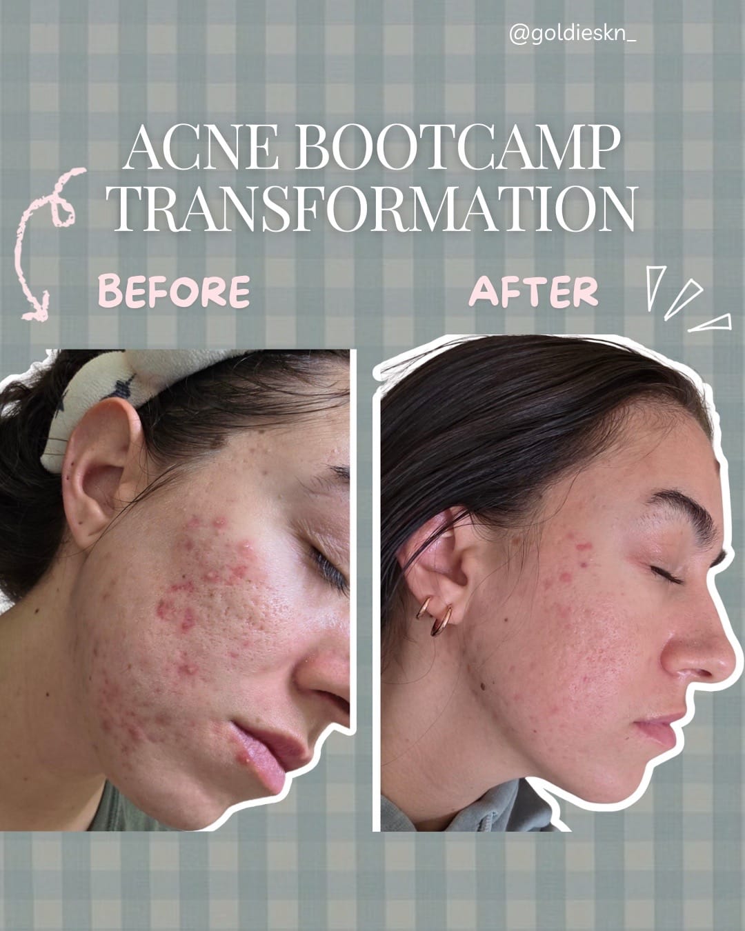 Post 3 by zadi 💫 | utah esthetician on TikTok (video)