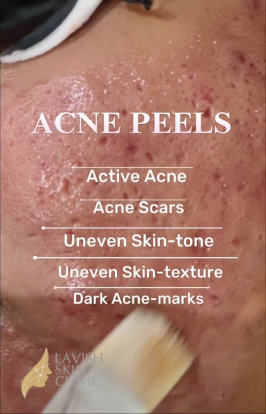 Post 5 by Lavish Skin Clinic on TikTok (video)
