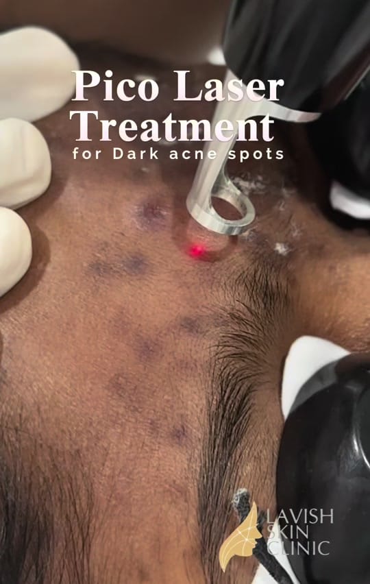 Post 4 by Lavish Skin Clinic on TikTok (video)