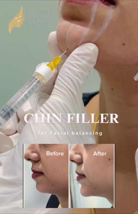 Post 3 by Lavish Skin Clinic on TikTok (video)