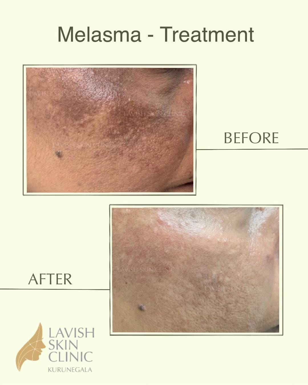 Post 2 by Lavish Skin Clinic on TikTok (video)