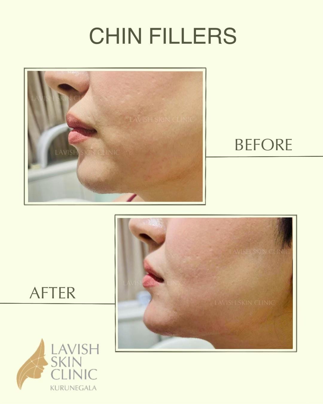 Post 6 by Lavish Skin Clinic on TikTok (video)