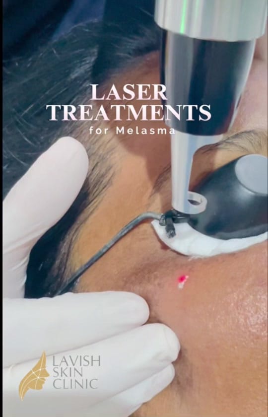 Post 8 by Lavish Skin Clinic on TikTok (video)