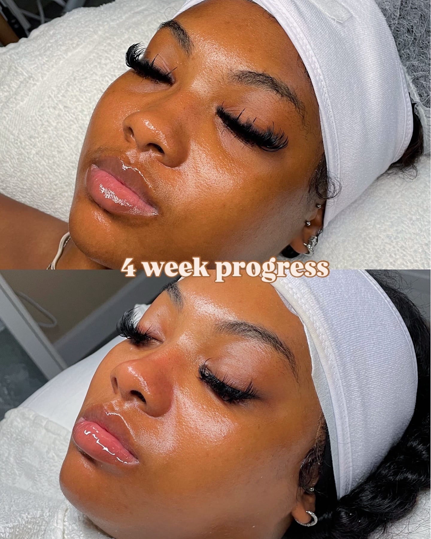Post 10 by Teshay | Atlanta Esthetician on TikTok (video)