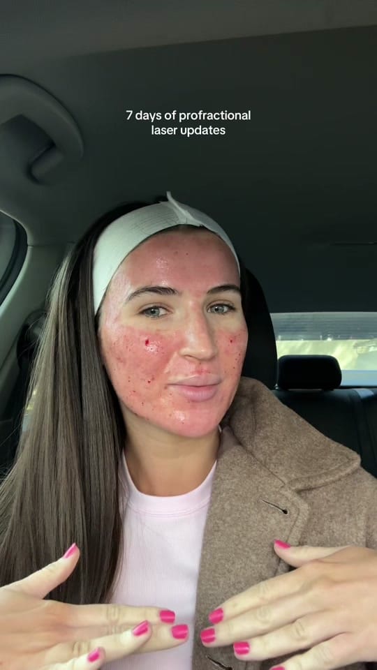 Post 4 by annabellerenee on TikTok (video)