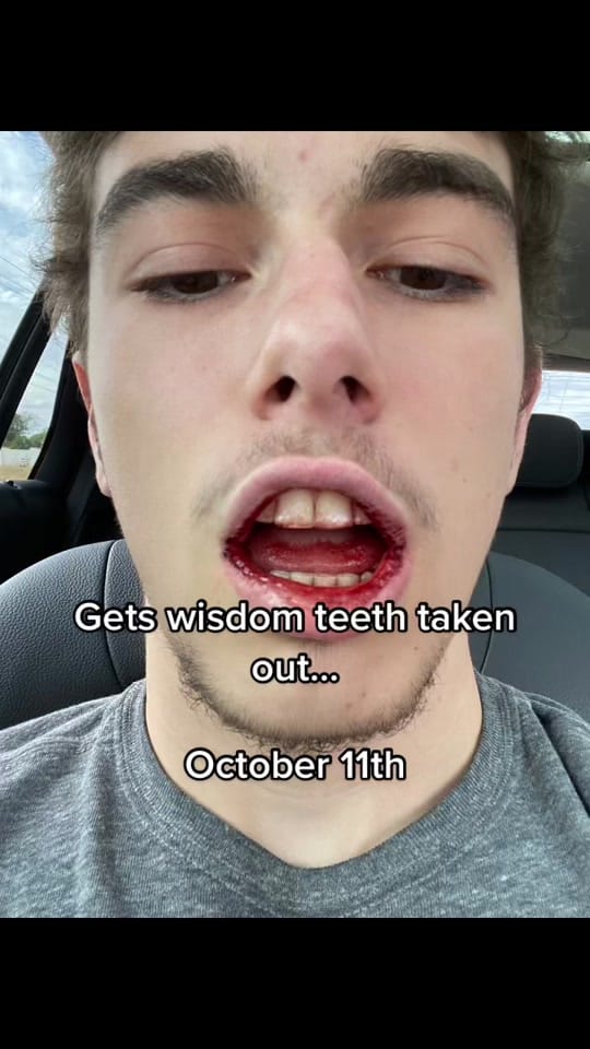 Post 2 by Brandon Lee😎 on TikTok (video)