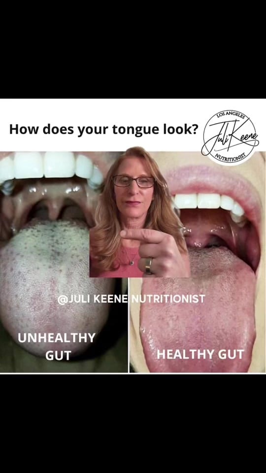 Post 7 by losangelesnutritionist on TikTok (video)