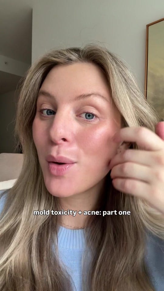 Post 6 by Sisley | The Acne Nutritionist on TikTok (video)