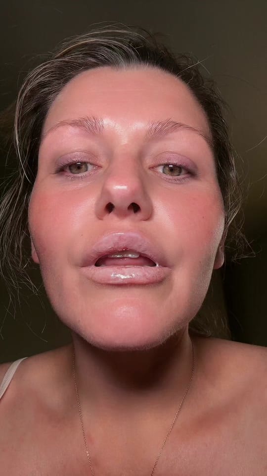 Post 6 by ChelseaJane || Aesthetician on TikTok (video)