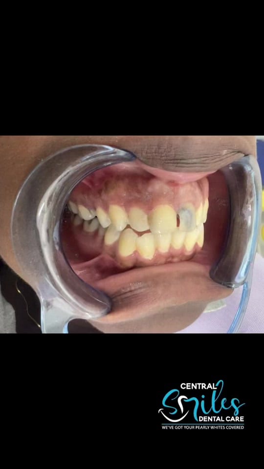 Post 9 by centralsmilesdentalcare on TikTok (video)