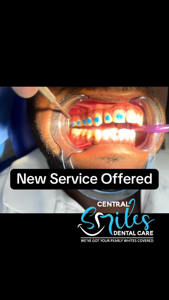 Post 8 by centralsmilesdentalcare on TikTok (video)