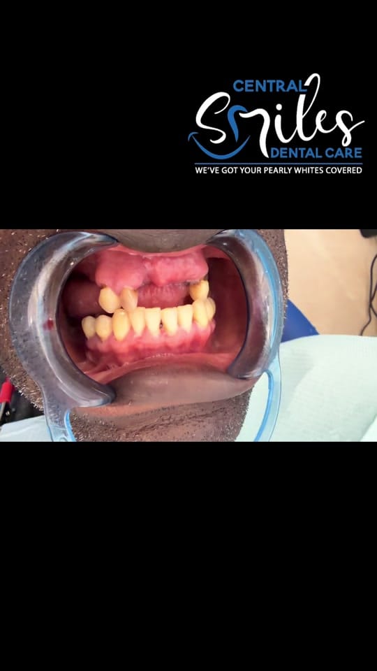 Post 2 by centralsmilesdentalcare on TikTok (video)