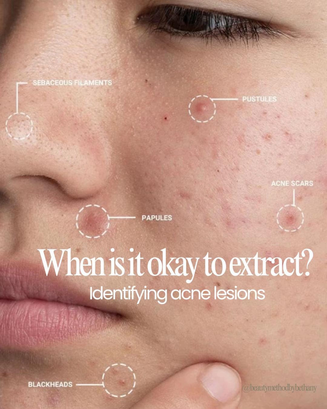 Post 6 by Beauty Method | Skin Therapist on TikTok (video)