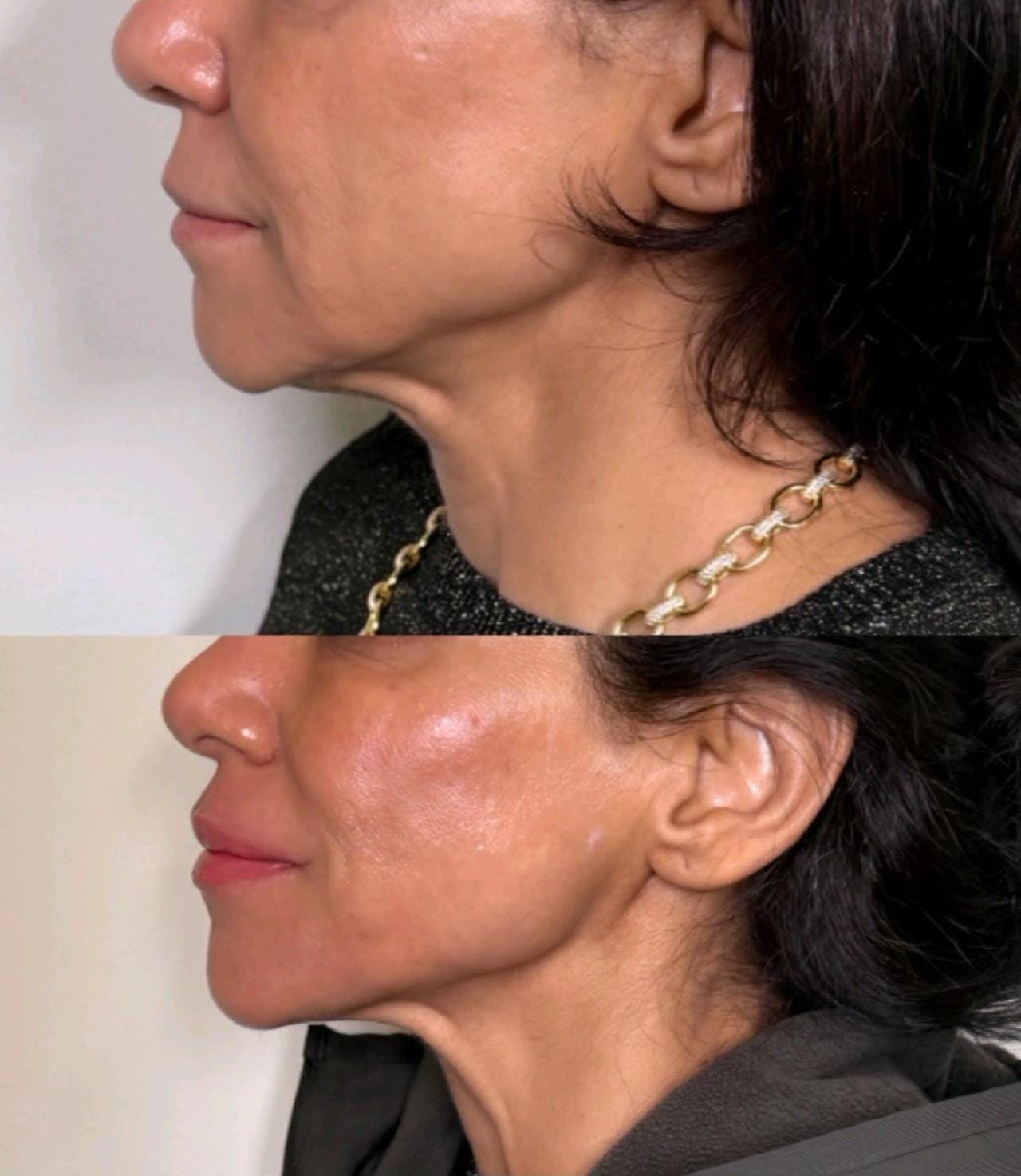 Post 1 by Beauty Method | Skin Therapist on TikTok (video)