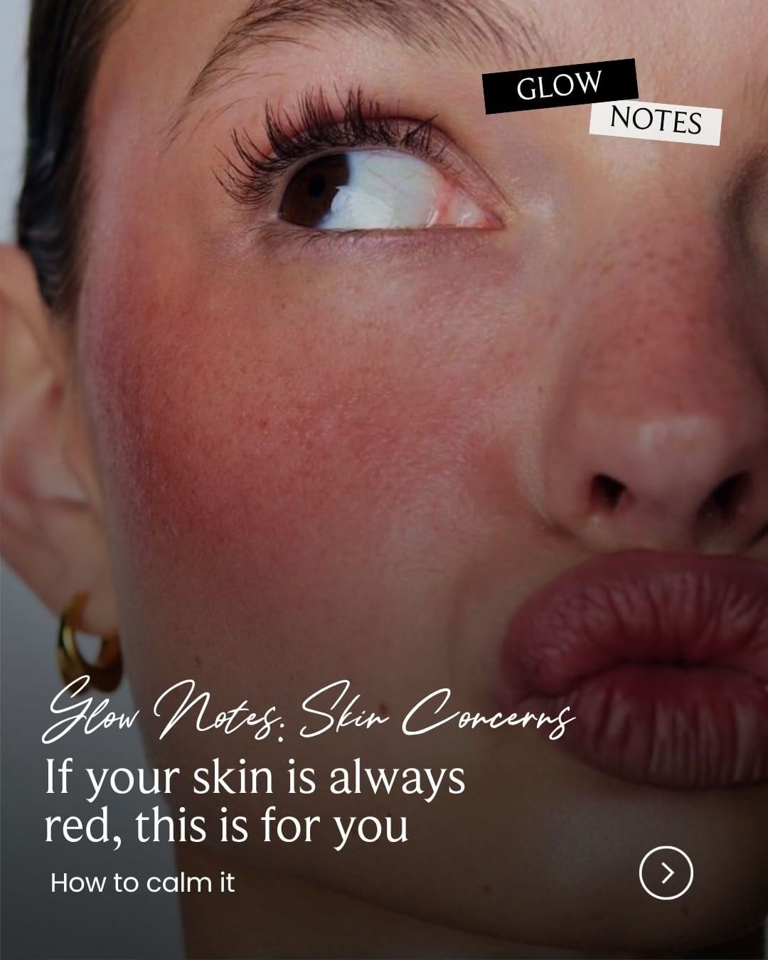 Post 7 by SkinShopIE on TikTok (video)