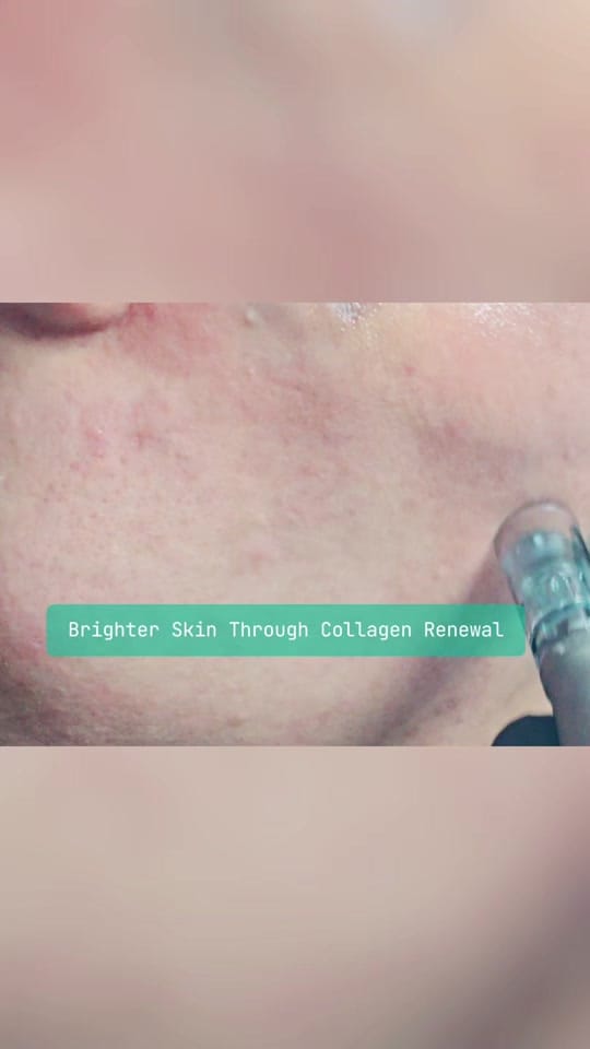 Post 8 by Pure Souls Therapy on TikTok (video)