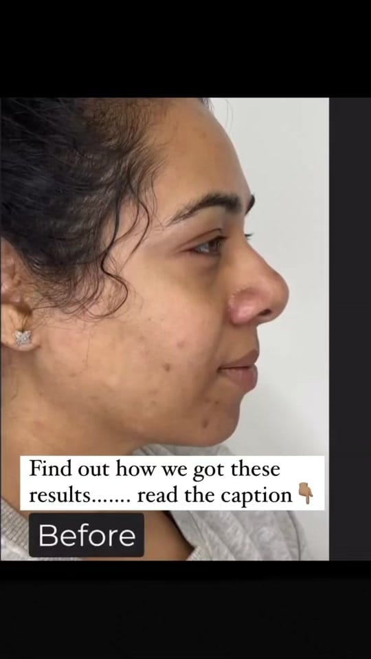Post 5 by Dr Uma Skin Clinic on TikTok (video)