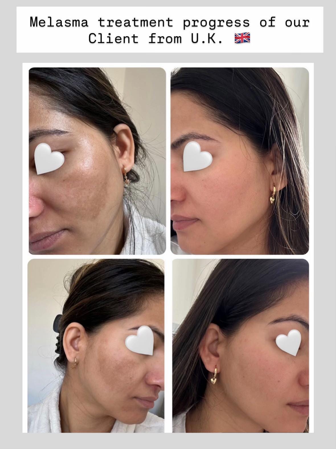 Post 9 by Skincarenepal on TikTok (video)
