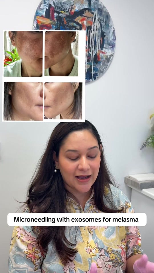 Post 4 by Skincarenepal on TikTok (video)