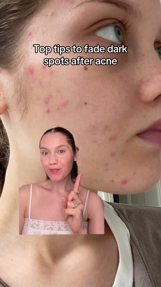 Post 7 by iona francis on TikTok (video)