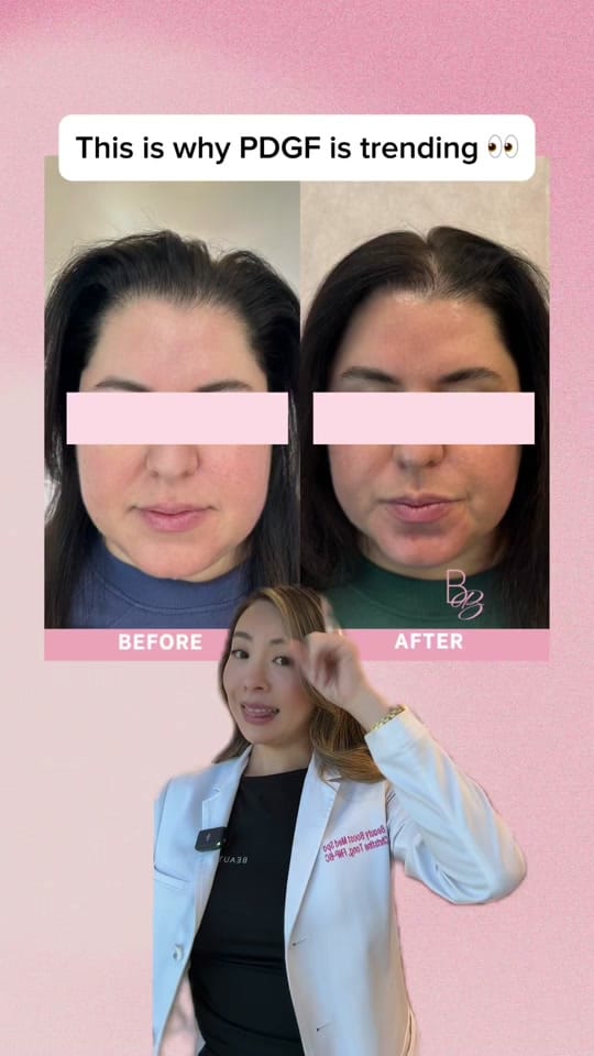 Post 9 by Beauty Boost Med Spa on TikTok (video)