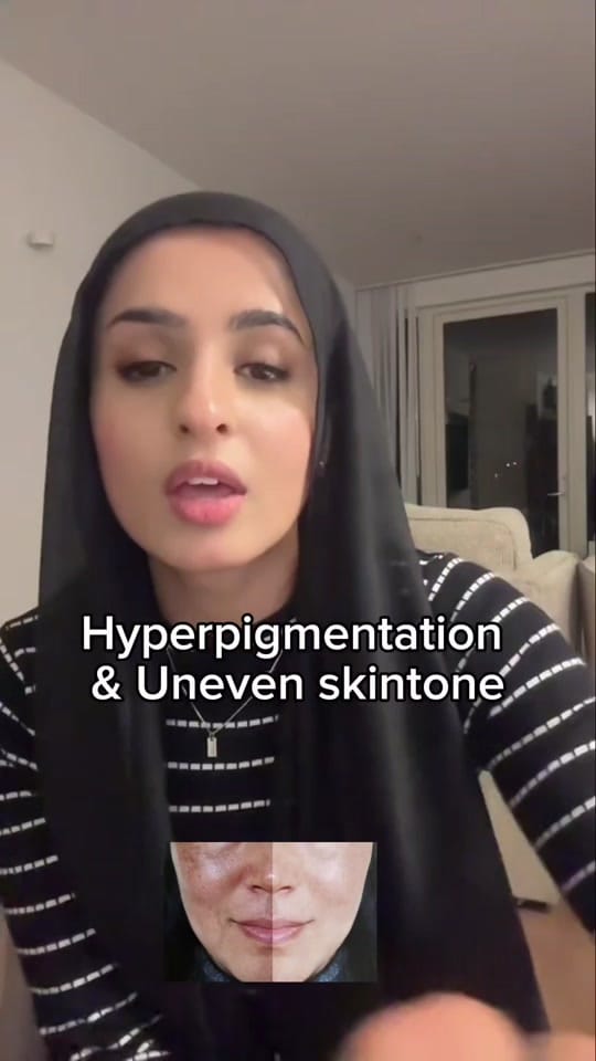 Post 3 by REFSA❤️ on TikTok (video)