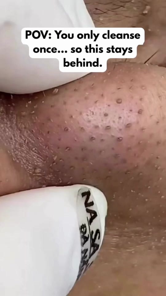 Post 7 by Like It On Top Skin on TikTok (video)