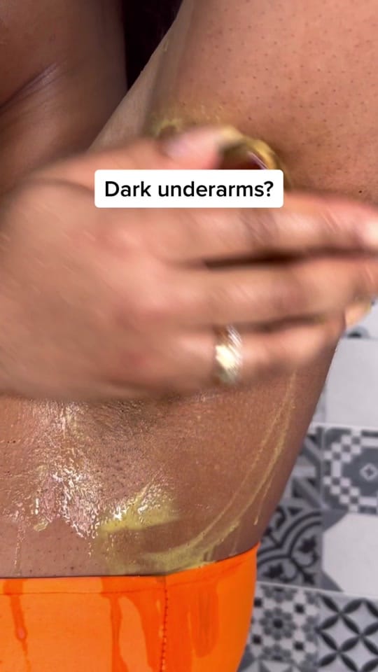 Post 9 by Like It On Top Skin on TikTok (video)