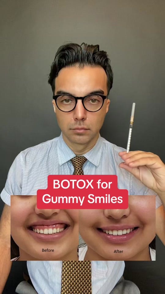 Post 9 by ocbeautymedspa on TikTok (video)