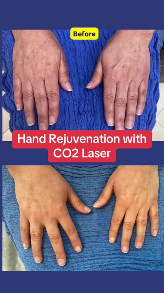 Post 4 by ocbeautymedspa on TikTok (video)