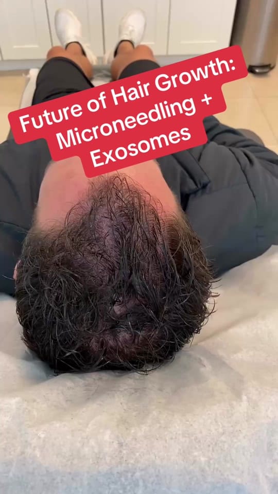 Post 5 by ocbeautymedspa on TikTok (video)