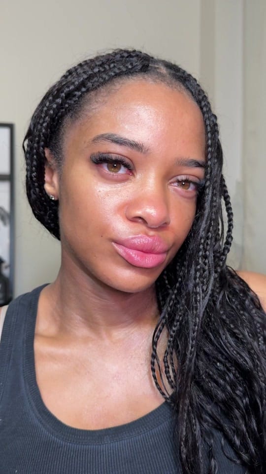 Post 6 by Neeka | Skin Expert ✨ on TikTok (video)