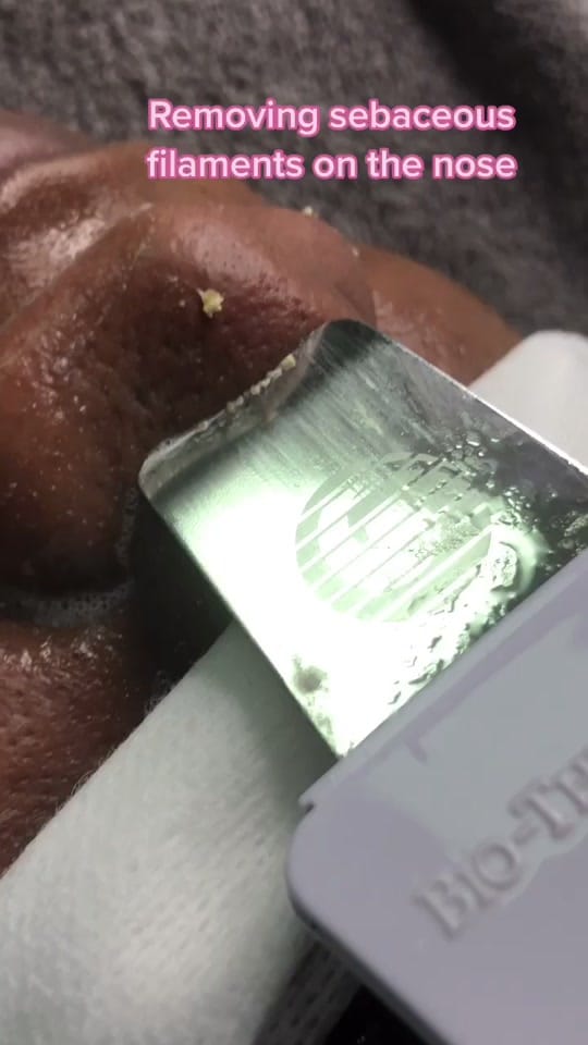 Post 10 by Neeka | Skin Expert ✨ on TikTok (video)