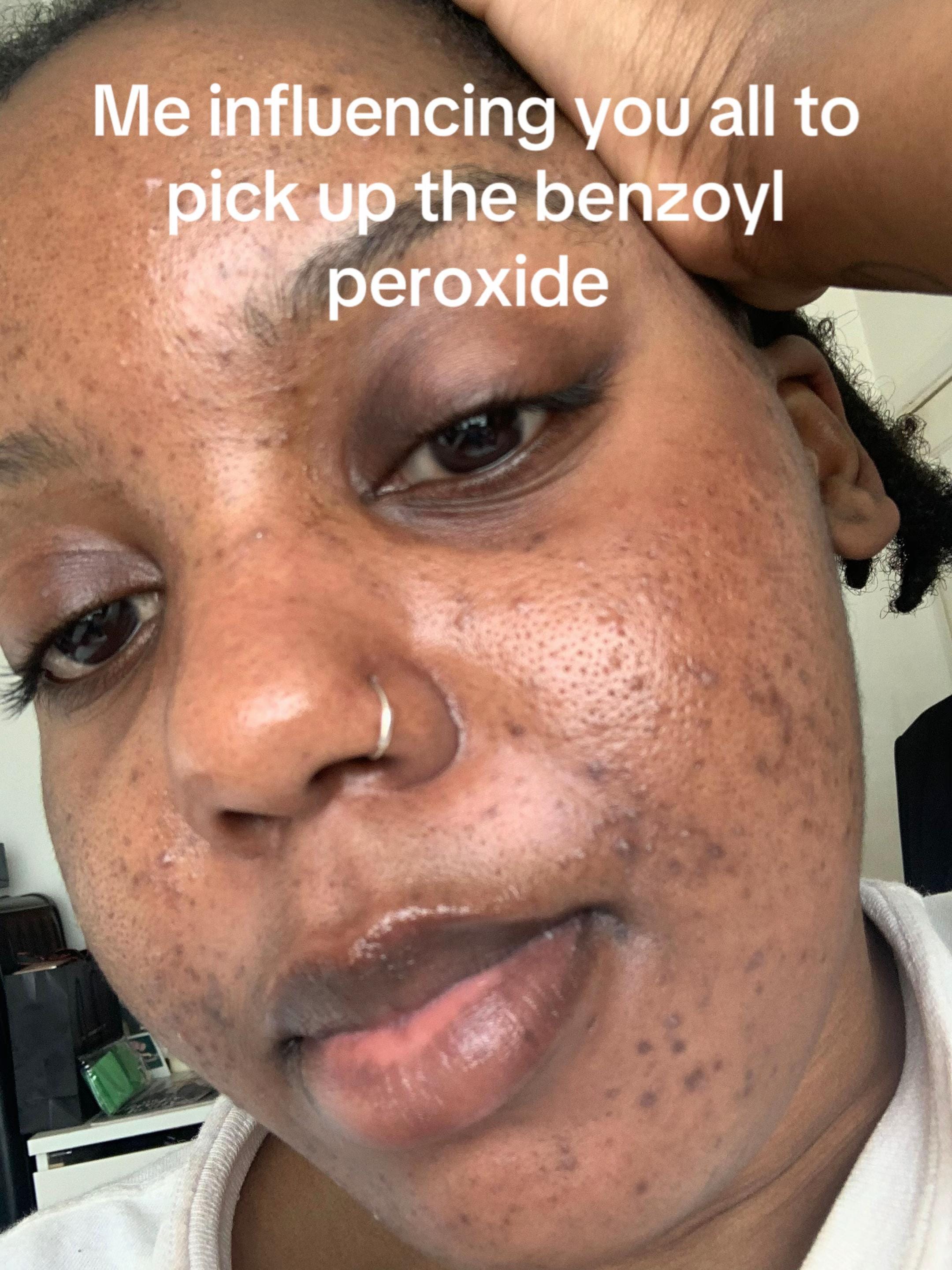 Post 8 by L Y N D A . S E M E on TikTok (video)