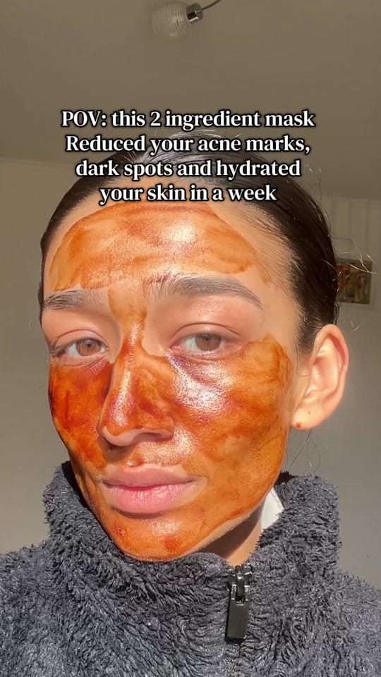 Post 8 by Tigma | Skincare & UGC 🎀 on TikTok (video)